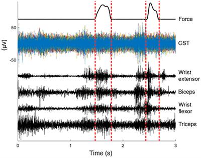 Convolutional Networks Outperform Linear Decoders in Predicting EMG From Spinal Cord Signals